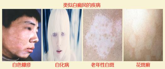 综